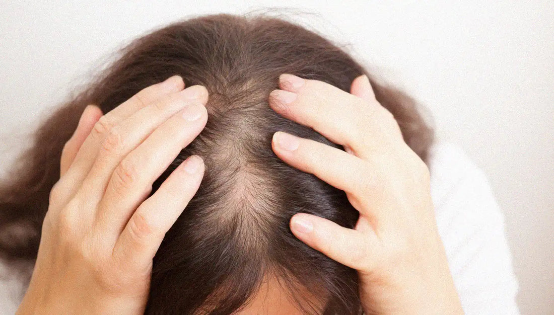 Thinning Hair in Women: Nutritional Deficiencies Explained